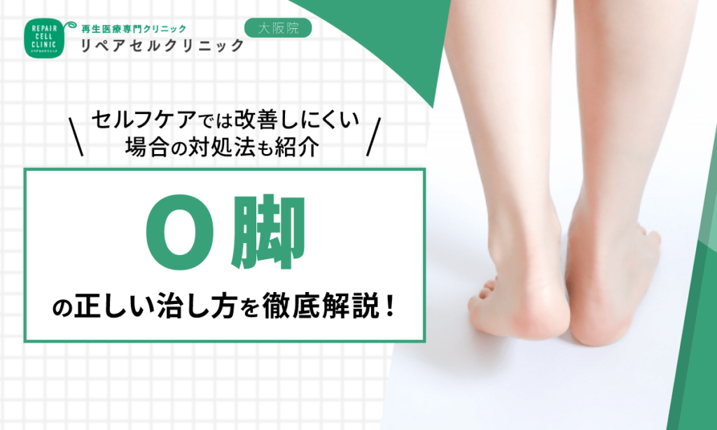 O脚の正しい治し方を徹底解説!セルフケアでは改善しにくい場合の対処法も紹介