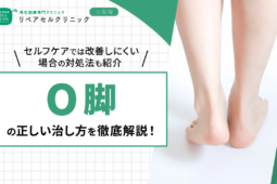O脚の正しい治し方を徹底解説！セルフケアでは改善しにくい場合の対処法も紹介