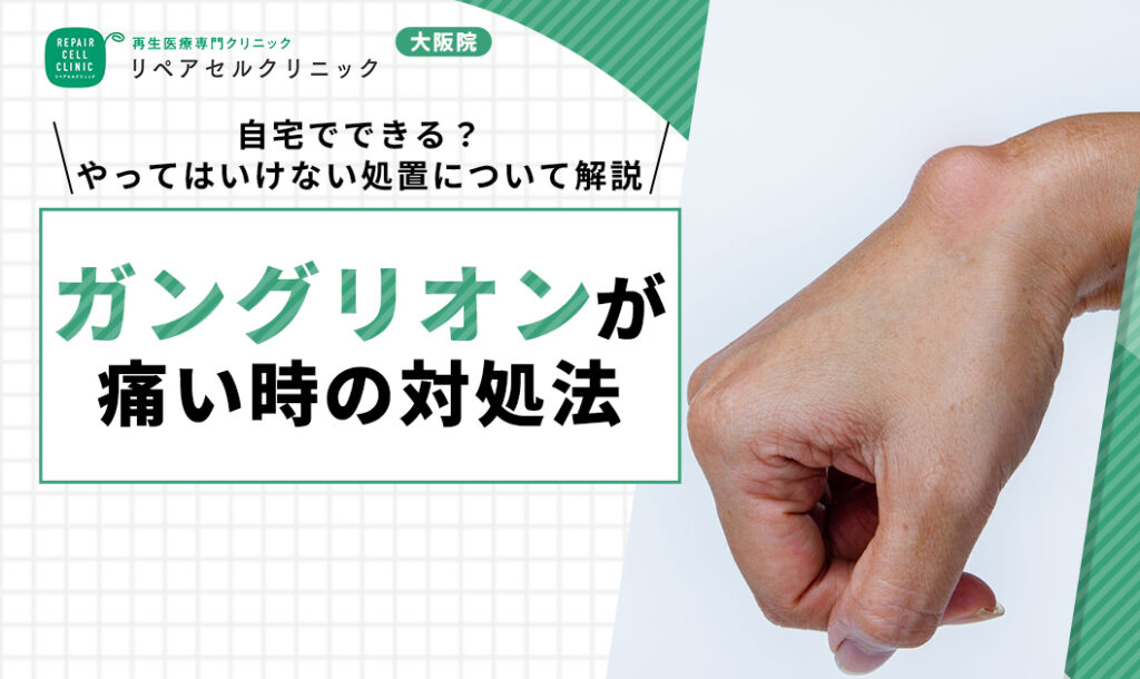 ガングリオン痛い時 対処法