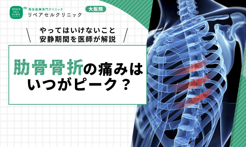 肋骨骨折の痛みはいつがピーク?やってはいけないこと・安静期間を医師が解説