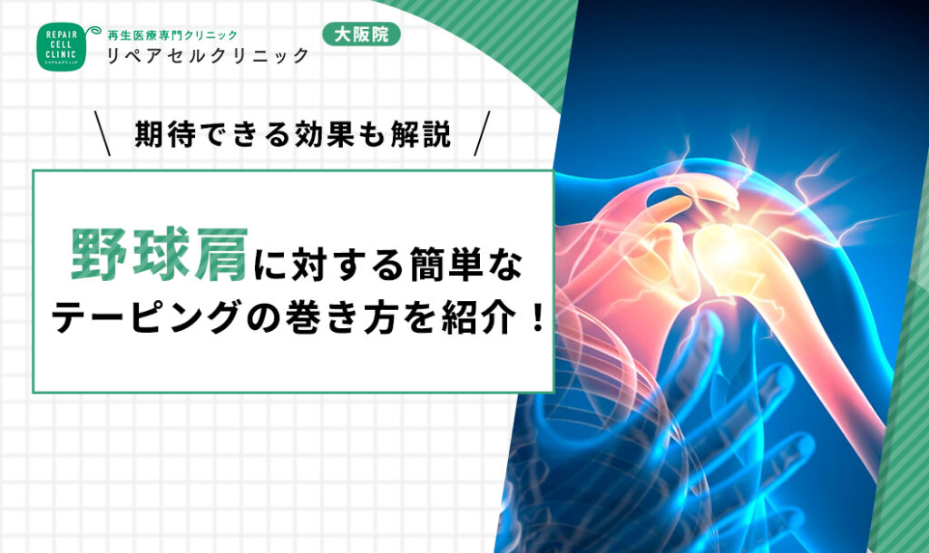 野球肩に対する簡単なテーピングの巻き方を紹介!期待できる効果も解説