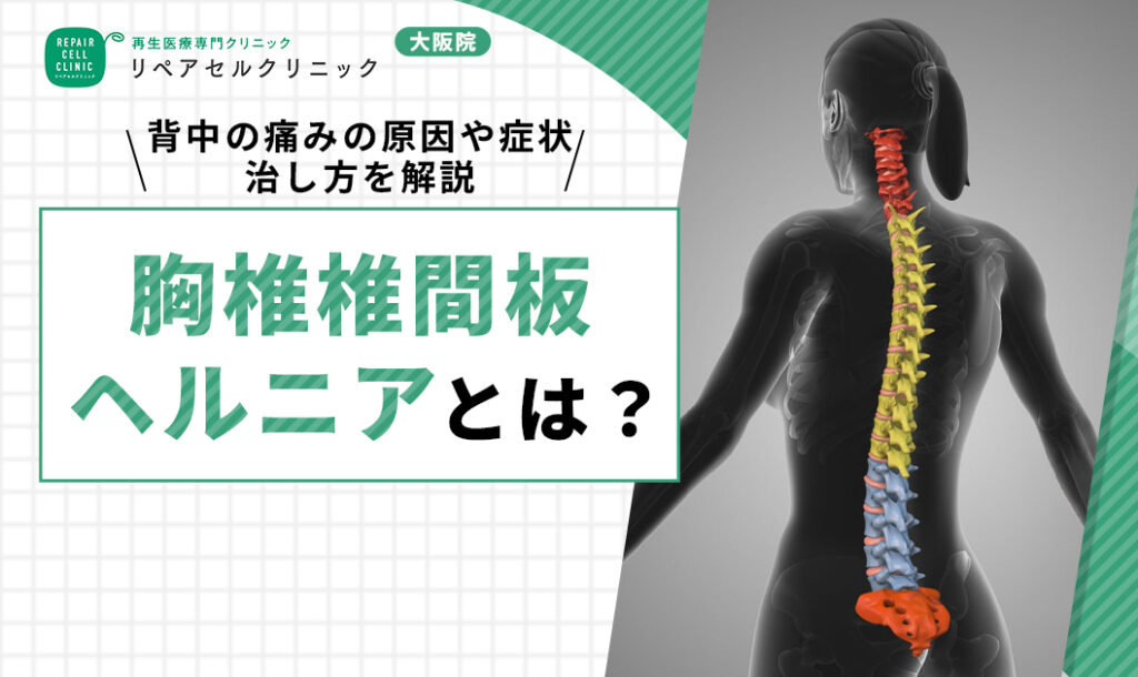 胸椎椎間板ヘルニアとは