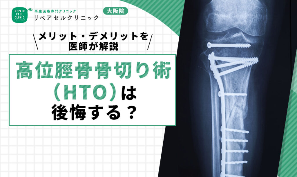 高位脛骨骨切り術（HTO）は後悔する？メリット・デメリットを医師が解説