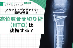 高位脛骨骨切り術(HTO)は後悔する?メリット・デメリットを医師が解説