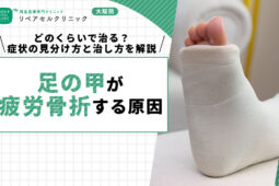足の甲が疲労骨折する原因|どのくらいで治る?症状の見分け方と治し方を解説