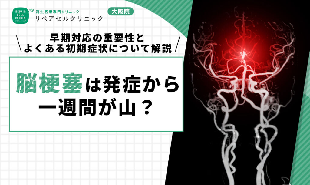 脳梗塞は発症から一週間が山？早期対応の重要性とよくある初期症状について解説