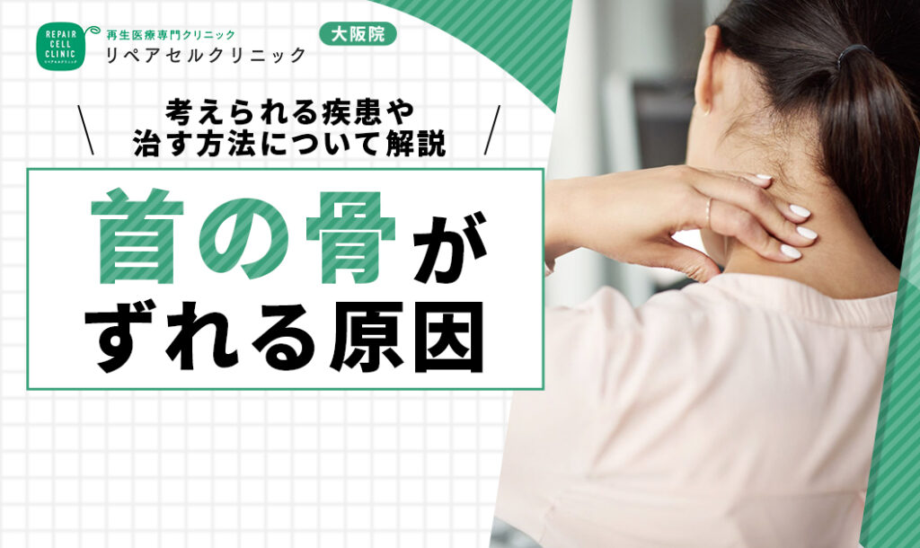 首の骨がずれる原因｜考えられる疾患や治す方法について解説【医師監修】