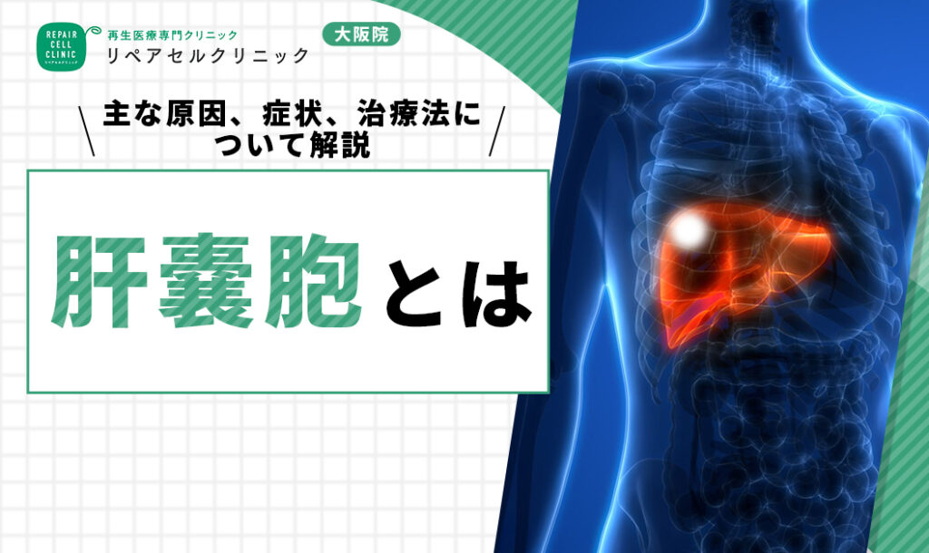 肝嚢胞とは｜主な原因、症状、治療法について解説【医師監修】