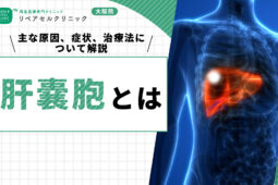 肝嚢胞とは|主な原因、症状、治療法について解説【医師監修】