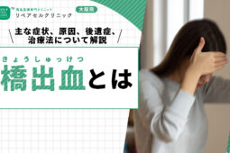 橋出血とは|主な症状、原因、後遺症、治療法について詳しく解説【医師監修】