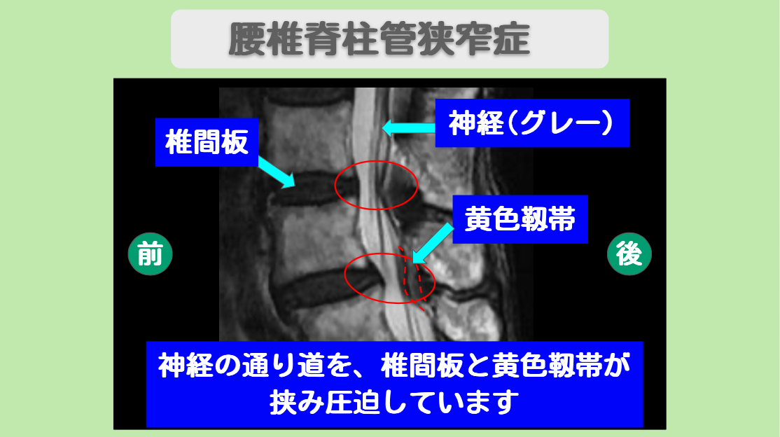 9185ca13a55e54dc378111dc7780a3d8