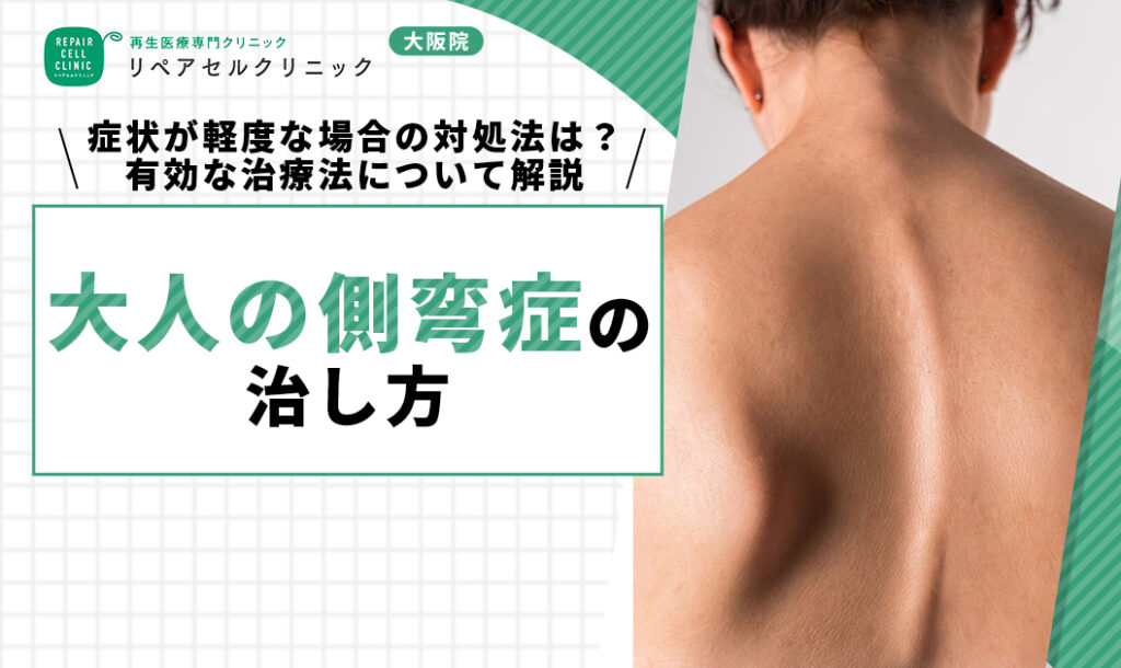 大人の側弯症の治し方｜症状が軽度な場合の対処法は？有効な治療法について解説