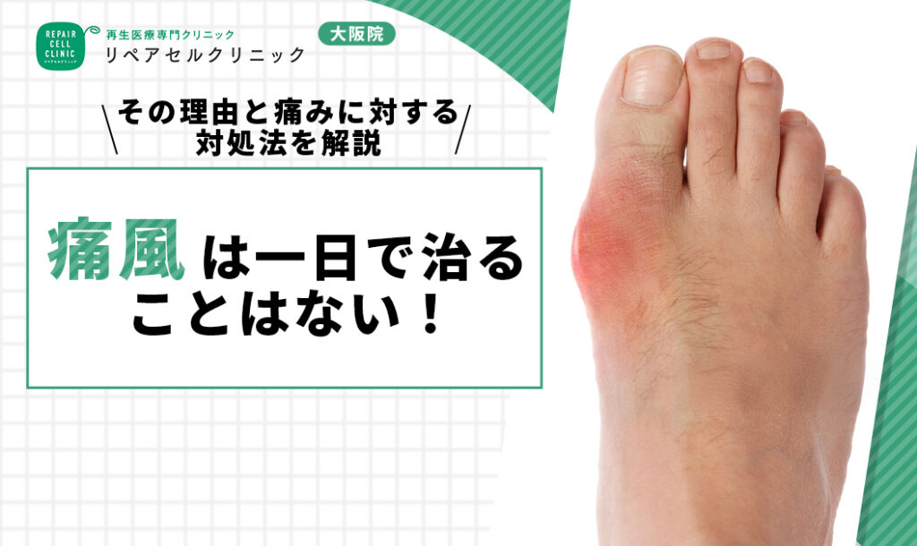 痛風は一日で治ることはない！その理由と痛みに対する対処法を解説