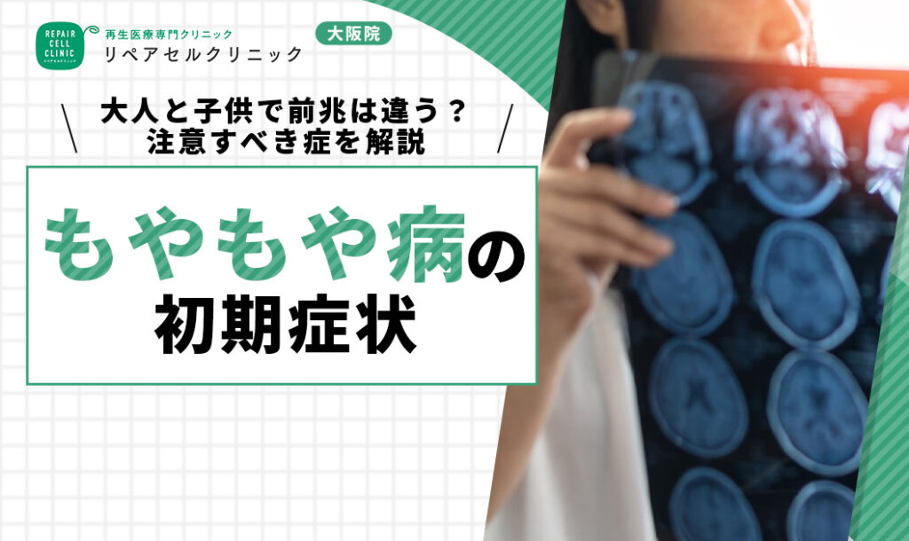 もやもや病の初期症状｜大人と子供で前兆は違う？注意すべき症状について解説