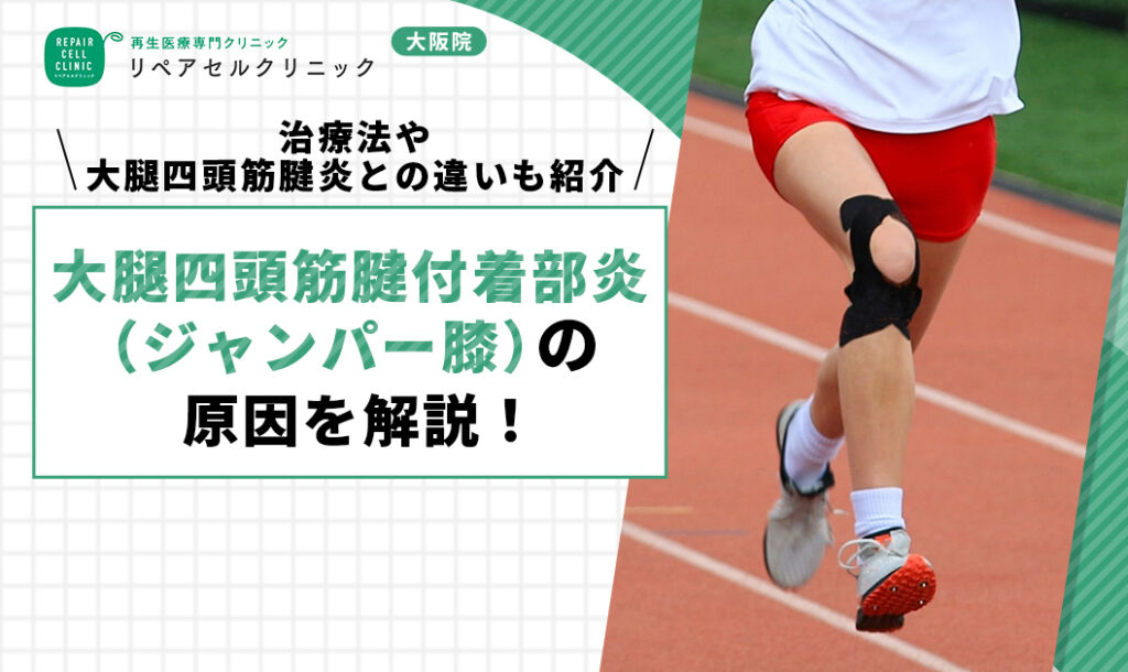 大腿四頭筋腱付着部炎（ジャンパー膝）の原因を解説！治療法や大腿四頭筋腱炎との違いも紹介