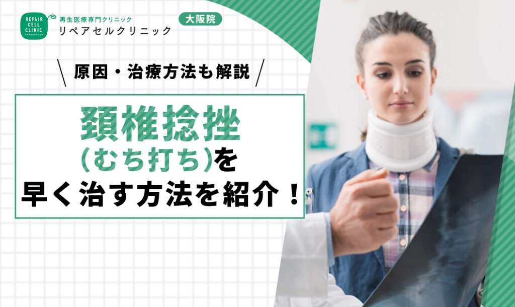 頚椎捻挫（むち打ち）を早く治す方法を紹介！原因・治療・自宅でできる方法も解説