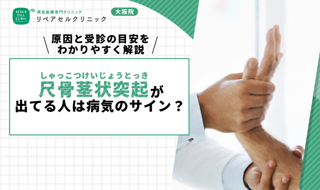 尺骨茎状突起が出てる人は病気のサイン？原因と受診の目安をわかりやすく解説