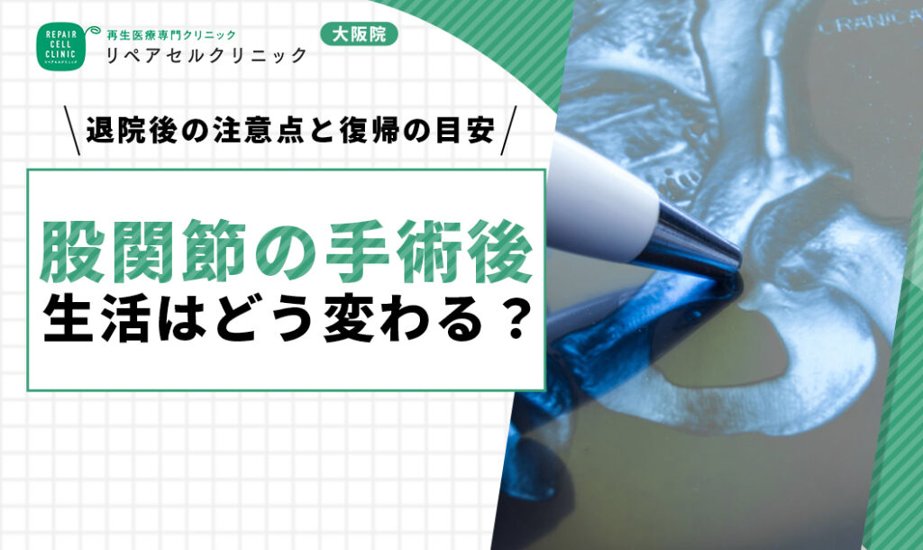 股関節の手術後、生活はどう変わる？退院後の注意点と復帰の目安を紹介