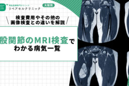 股関節のMRI検査でわかる病気一覧｜検査費用やその他の画像検査との違いを解説