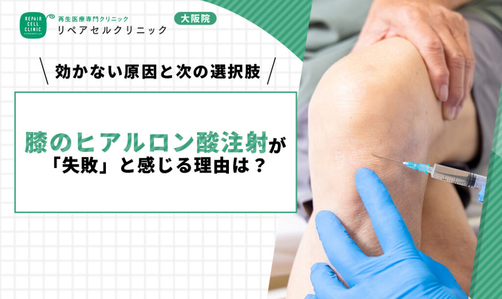 膝のヒアルロン酸注射が「失敗」と感じる理由は？効かない原因と次の選択肢を紹介