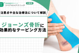 ジョーンズ骨折に効果的なテーピング方法｜注意点や主な治療法について解説