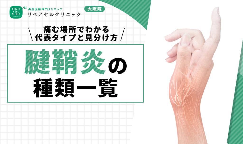 腱鞘炎の種類一覧｜痛む場所でわかる代表タイプと見分け方を紹介