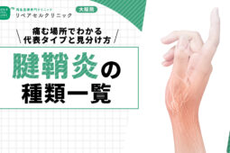 腱鞘炎の種類一覧|痛む場所でわかる代表タイプと見分け方を紹介