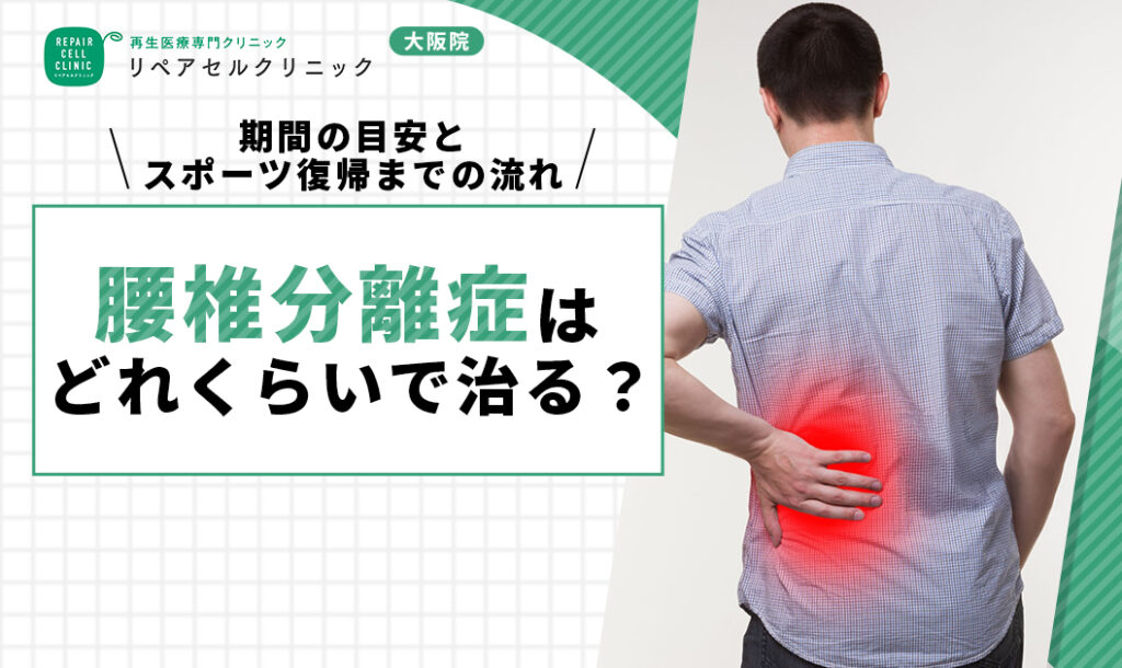 腰椎分離症はどれくらいで治る？期間の目安とスポーツ復帰までの流れ