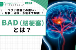 BAD（脳梗塞）とは？ラクナ梗塞との違い・症状・治療・予後まで解説