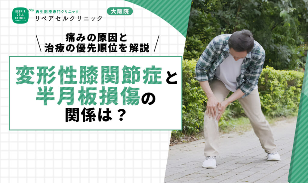 変形性膝関節症と半月板損傷の関係は？痛みの原因と治療の優先順位を解説
