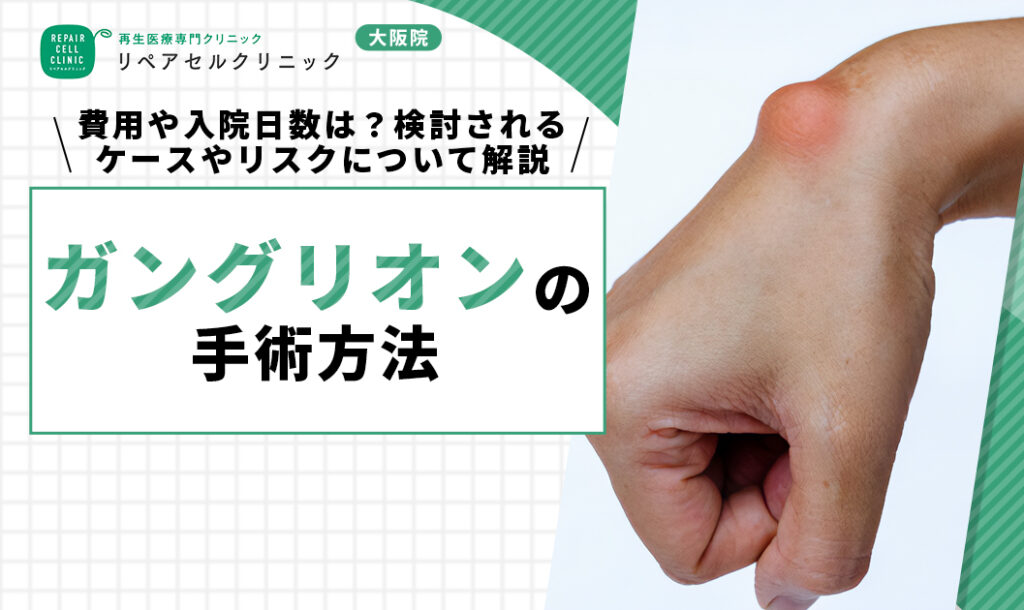ガングリオンの手術方法｜費用や入院日数は？検討されるケースやリスクについて解説