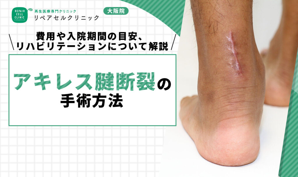 アキレス腱断裂の手術方法｜費用や入院期間の目安、リハビリテーションについて解説