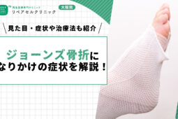 ジョーンズ骨折になりかけの症状を解説！見た目・症状や治療法も紹介