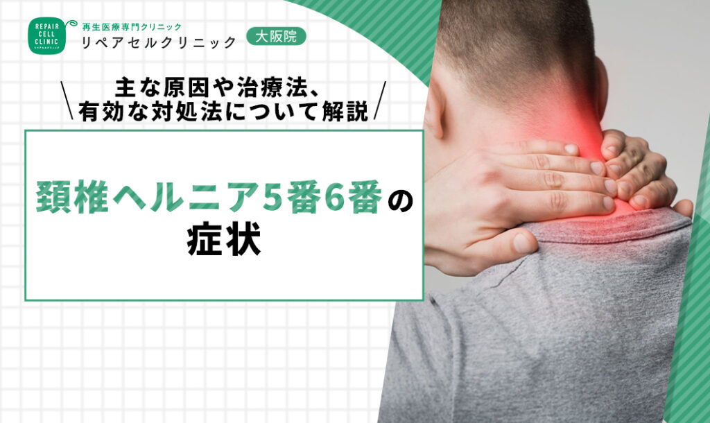 頚椎ヘルニア5番6番の症状｜主な原因や治療法、有効な対処法について解説