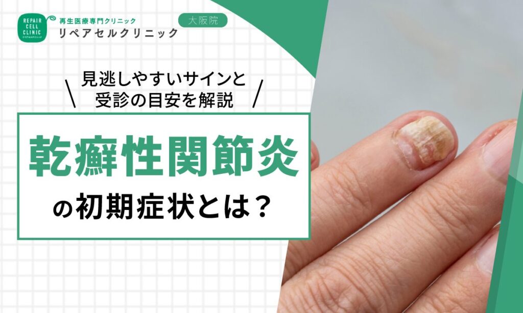 乾癬性関節炎の初期症状とは？見逃しやすいサインと早期受診の目安を解説