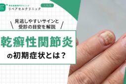 乾癬性関節炎の初期症状とは?見逃しやすいサインと早期受診の目安を解説