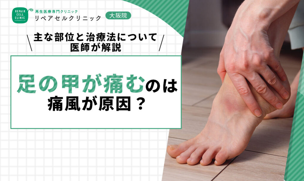 足の甲が痛むのは痛風が原因？主な部位と治療法について医師が解説