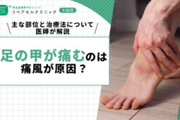 足の甲が痛むのは痛風が原因?主な部位と治療法について医師が解説