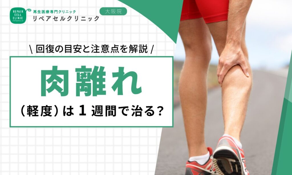 肉離れ(軽度)は1週間で治る?回復の目安と注意点を解説