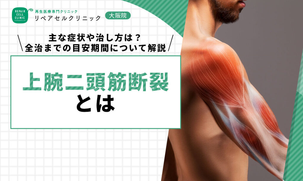 上腕二頭筋断裂とは|主な症状や治し方は?全治までの目安期間について解説【医師監修】