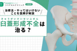臼蓋形成不全は治る?治療法・やってはいけないことを医師が解説