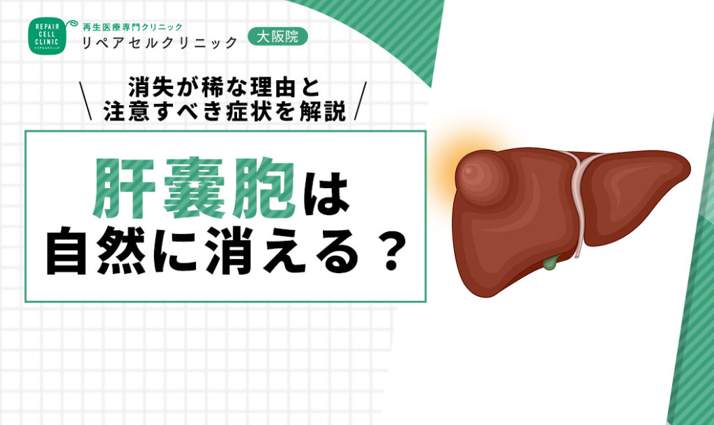 肝嚢胞は自然に消える？消失が稀な理由と注意すべき症状を解説