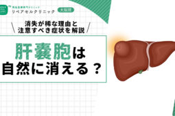 肝嚢胞は自然に消える？消失が稀な理由と注意すべき症状を解説