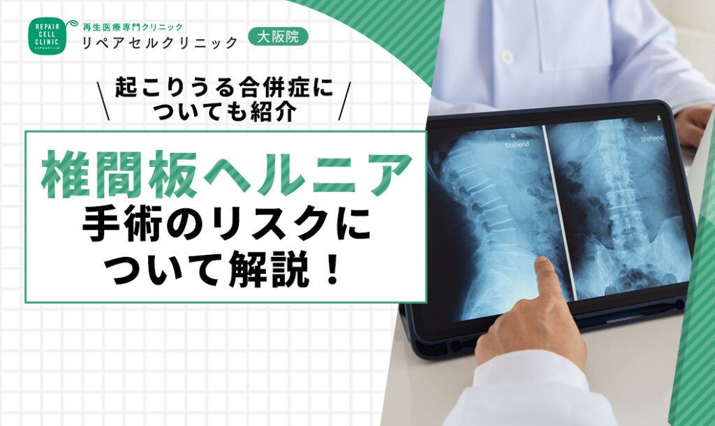 椎間板ヘルニア手術のリスクについて解説！起こりうる合併症についても紹介