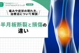 半月板断裂と損傷の違い｜痛みや症状の現れ方、治療法について解説【医師監修】