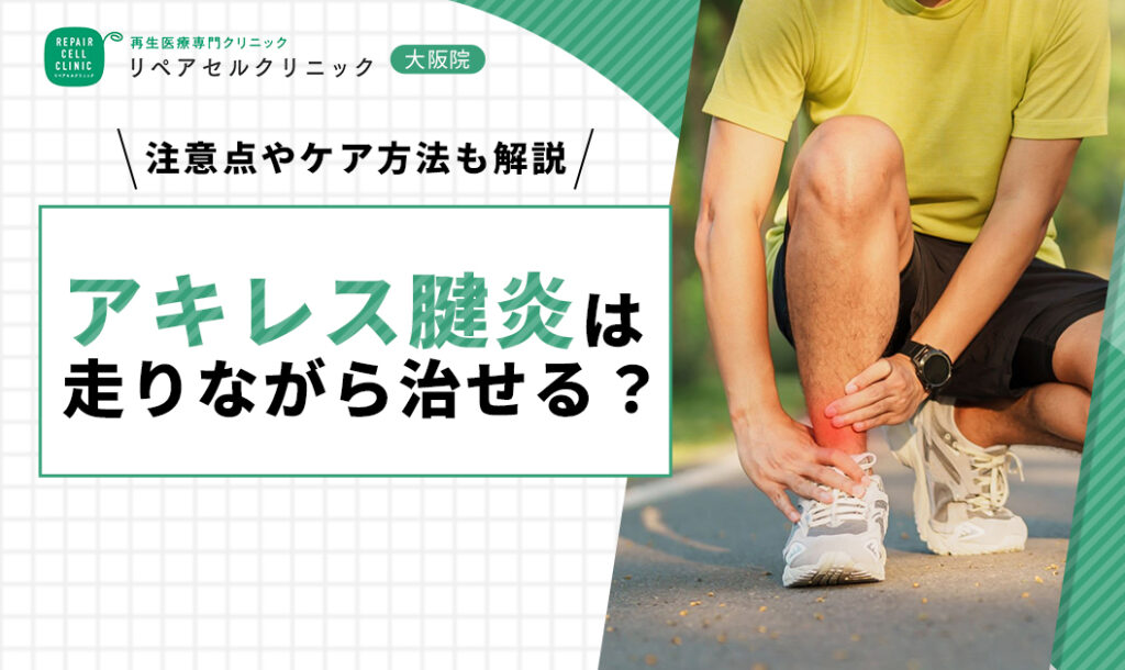 アキレス腱炎は走りながら治せる？注意点やケア方法も解説