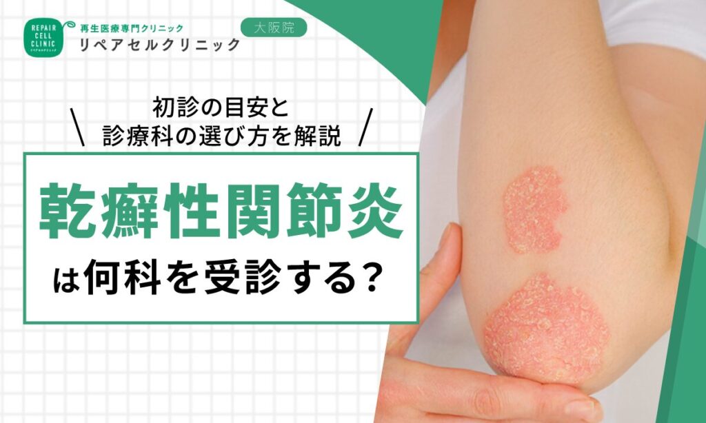 乾癬性関節炎は何科を受診する？初診の目安と診療科の選び方を解説