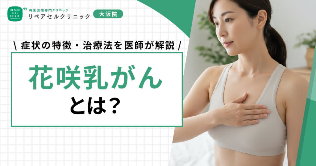 花咲乳がんとは？症状の特徴・治療法を医師が解説
