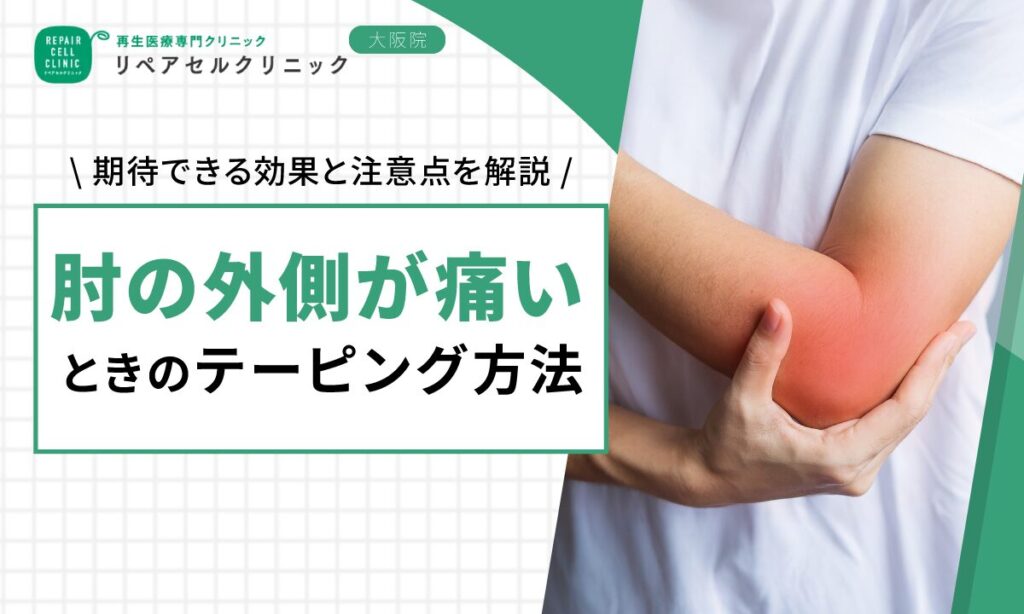 肘の外側が痛いときのテーピング方法｜期待できる効果と注意点を解説