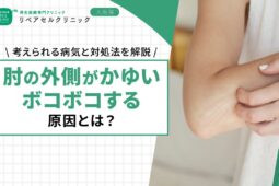 肘の外側がかゆい・ボコボコする原因とは?考えられる病気と対処法を解説